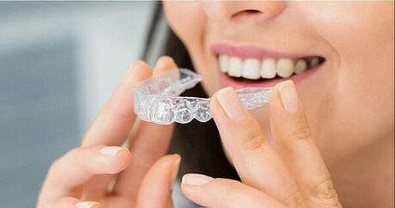 aligner.jpg 